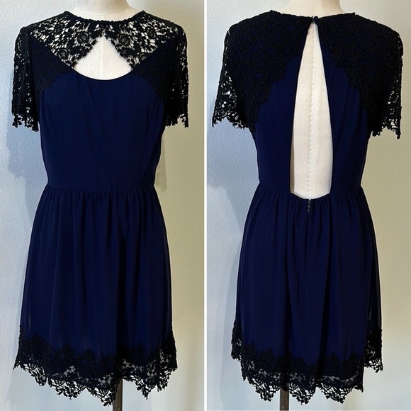 Pins and Needles Navy Blue and Black Lace Caplet Dress - M - Picture 1 of 10